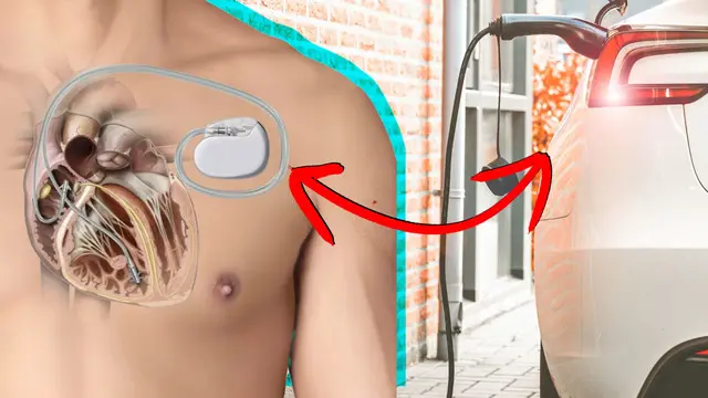 Kalp Pili Takan Kişiler Elektrikli Araç Kullanabilir mi?